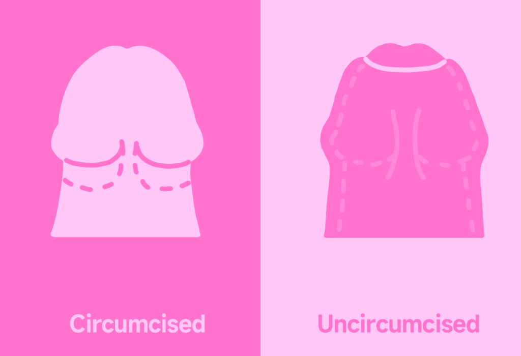 Curious About the Different Kinds and Shapes of Penises? Here’s What Variety Looks Like 5 circumcised penis
